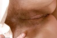 ATK hairy  in mature and hairy