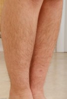 ATK hairy  in exotic and hairy