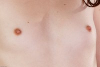 ATK hairy  in young and hairy