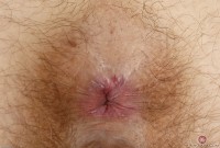 ATK hairy  in young and hairy