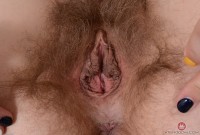 ATK hairy  in young and hairy