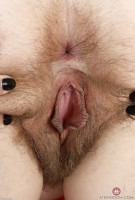 ATK hairy  in young and hairy