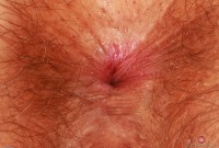 ATK hairy Felicia Fisher Set