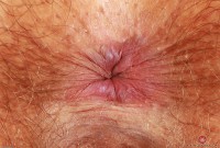 ATK hairy Felicia Fisher in scary hairy