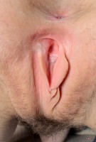 ATK hairy  in mature and hairy