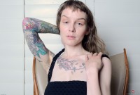 ATK hairy  in mature and hairy