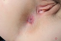 ATK hairy Finch Linden Set