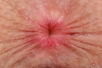 ATK hairy Fiona Peaches Set
