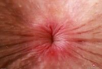 ATK hairy Fiona Peaches Set