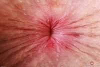 ATK hairy Fiona Peaches Set