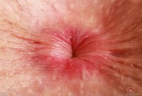 ATK hairy Fiona Peaches Set