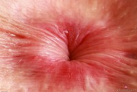 ATK hairy  in young and hairy