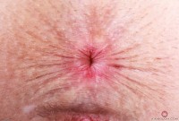 ATK hairy Fiona Peaches Set