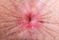 ATK hairy Fiona Peaches Set