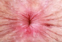 ATK hairy Fiona Peaches Set