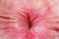 ATK hairy  in young and hairy