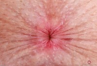 ATK hairy Fiona Peaches Set