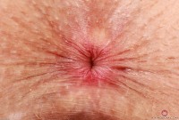 ATK hairy Fiona Peaches Set