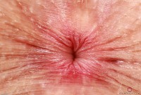 ATK hairy  in young and hairy