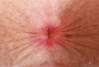 ATK hairy Fiona Peaches Set