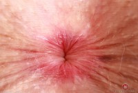 ATK hairy Fiona Peaches Set