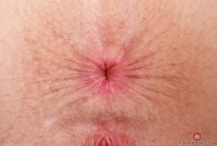 ATK hairy  in young and hairy