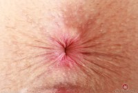 ATK hairy Fiona Peaches Set