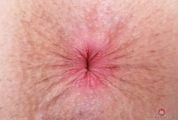 ATK hairy  in young and hairy