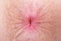 ATK hairy Fiona Peaches Set