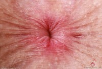 ATK hairy Fiona Peaches Set