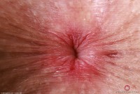 ATK hairy Fiona Peaches Set