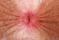 ATK hairy Fiona Peaches Set