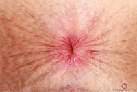 ATK hairy Fiona Peaches Set