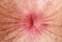 ATK hairy Fiona Peaches in young and hairy