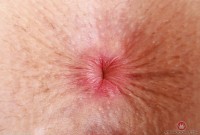 ATK hairy Fiona Peaches Set