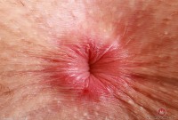 ATK hairy Fiona Peaches in young and hairy