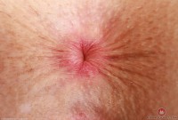 ATK hairy Fiona Peaches in young and hairy