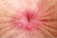 ATK hairy Fiona Peaches Set