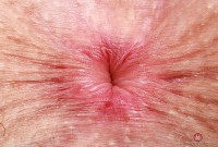 ATK hairy Fiona Peaches in young and hairy