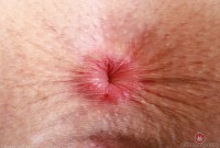 ATK hairy Fiona Peaches Set