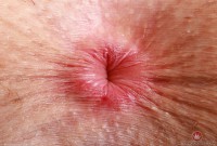 ATK hairy Fiona Peaches in young and hairy