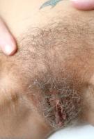 ATK hairy  in mature and hairy