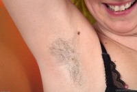 ATK hairy  in mature and hairy
