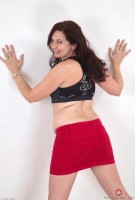 ATK hairy  in mature and hairy