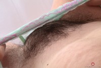 ATK hairy  in mature and hairy