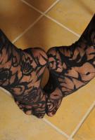 ATK hairy  in young and hairy