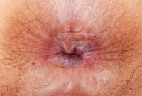ATK hairy Gemma Naya Set