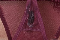 ATK hairy  in mature and hairy