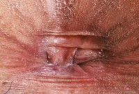 ATK hairy  in exotic and hairy