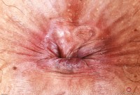 ATK hairy Gemma Naya Set